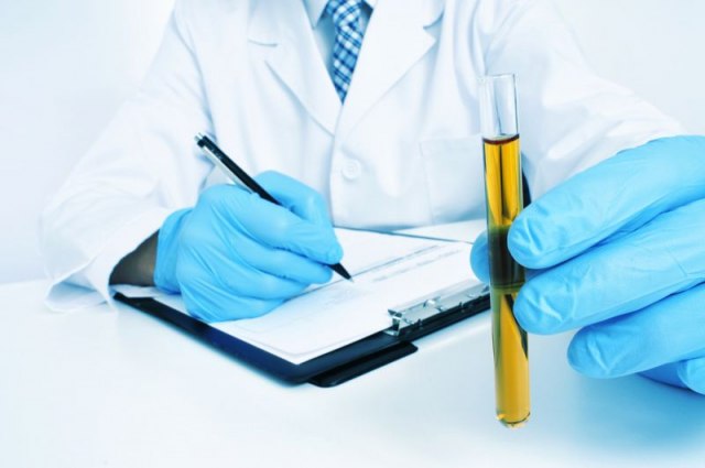 Novi test urina otkriva rak u ranoj fazi